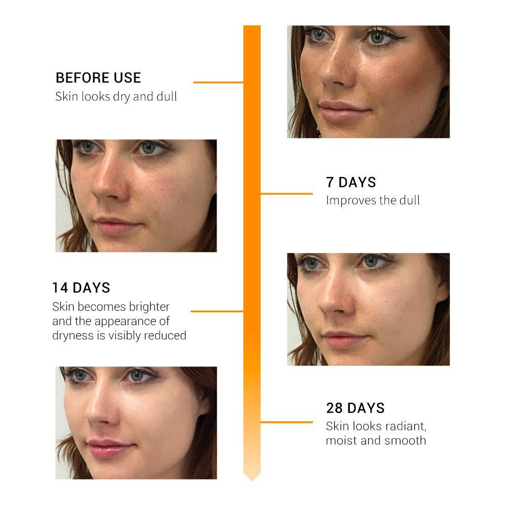 Revitalize Your Skin with Matrixyl 3000 Peptide Cream - Anti-Aging Formula with Hyaluronic Acid, Retinol, and Vitamin C