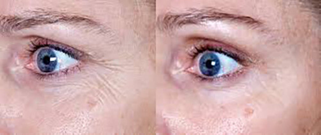 Revitalize Your Skin with Matrixyl 3000 Peptide Cream - Anti-Aging Formula with Hyaluronic Acid, Retinol, and Vitamin C