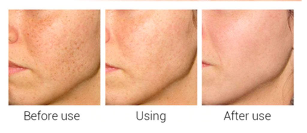 Revitalize Your Skin with Matrixyl 3000 Peptide Cream - Anti-Aging Formula with Hyaluronic Acid, Retinol, and Vitamin C