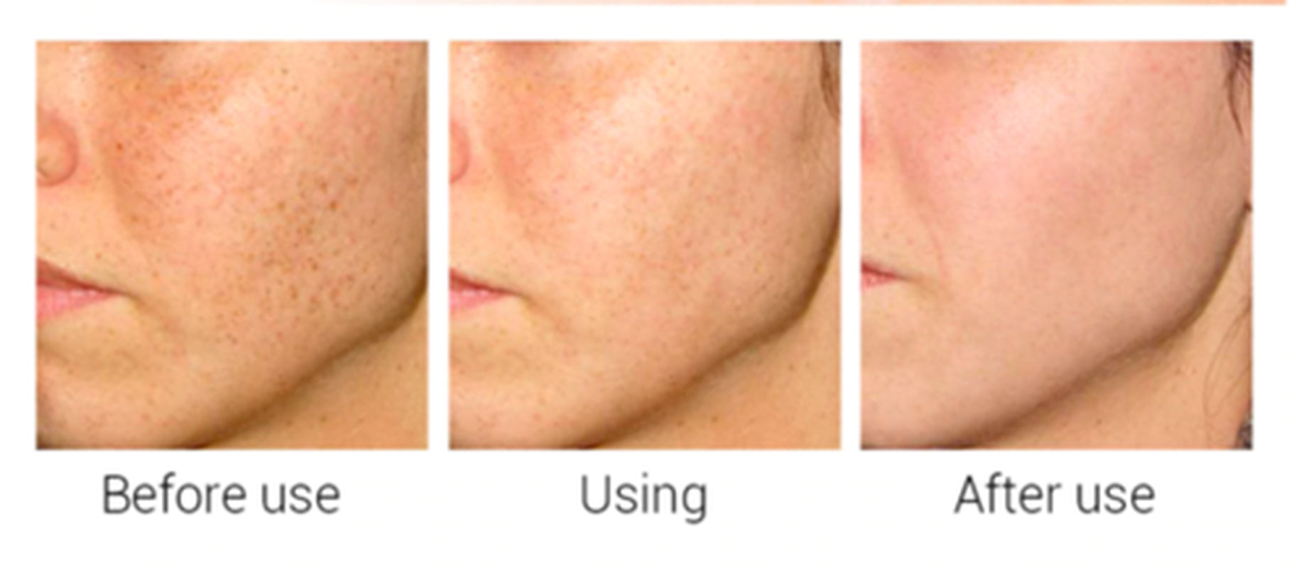 Revitalize Your Skin with Matrixyl 3000 Peptide Cream - Anti-Aging Formula with Hyaluronic Acid, Retinol, and Vitamin C