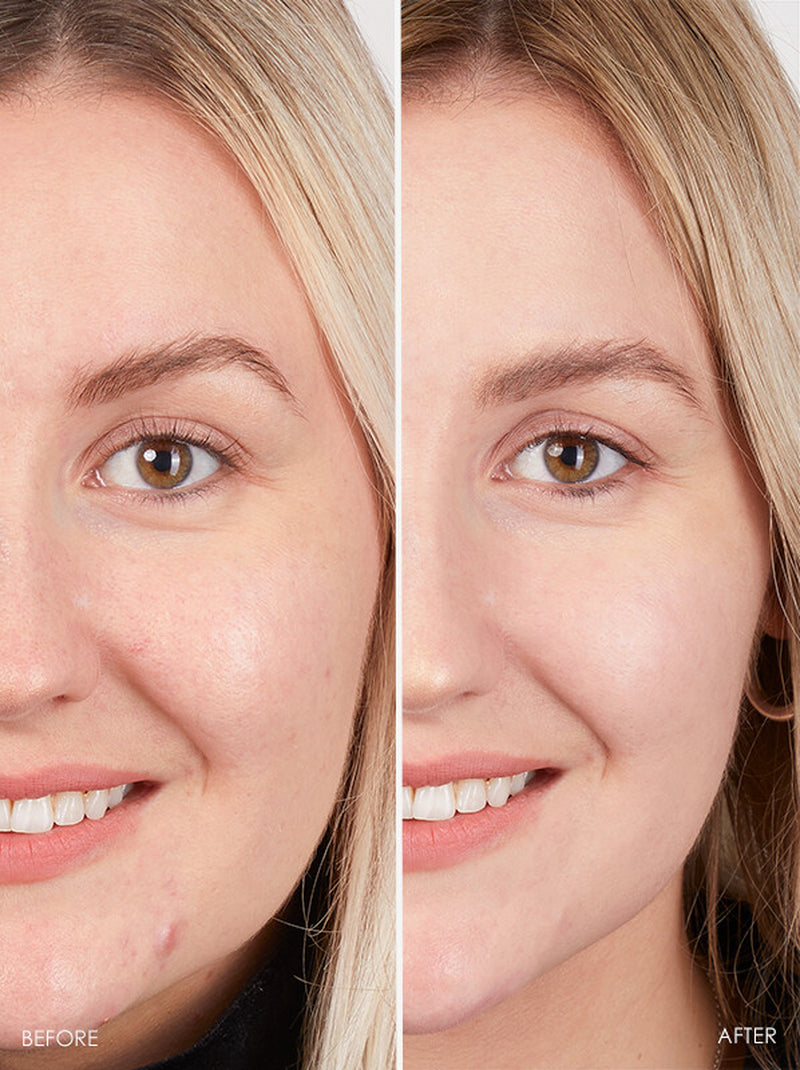 Revitalize Your Skin with Matrixyl 3000 Peptide Cream - Anti-Aging Formula with Hyaluronic Acid, Retinol, and Vitamin C
