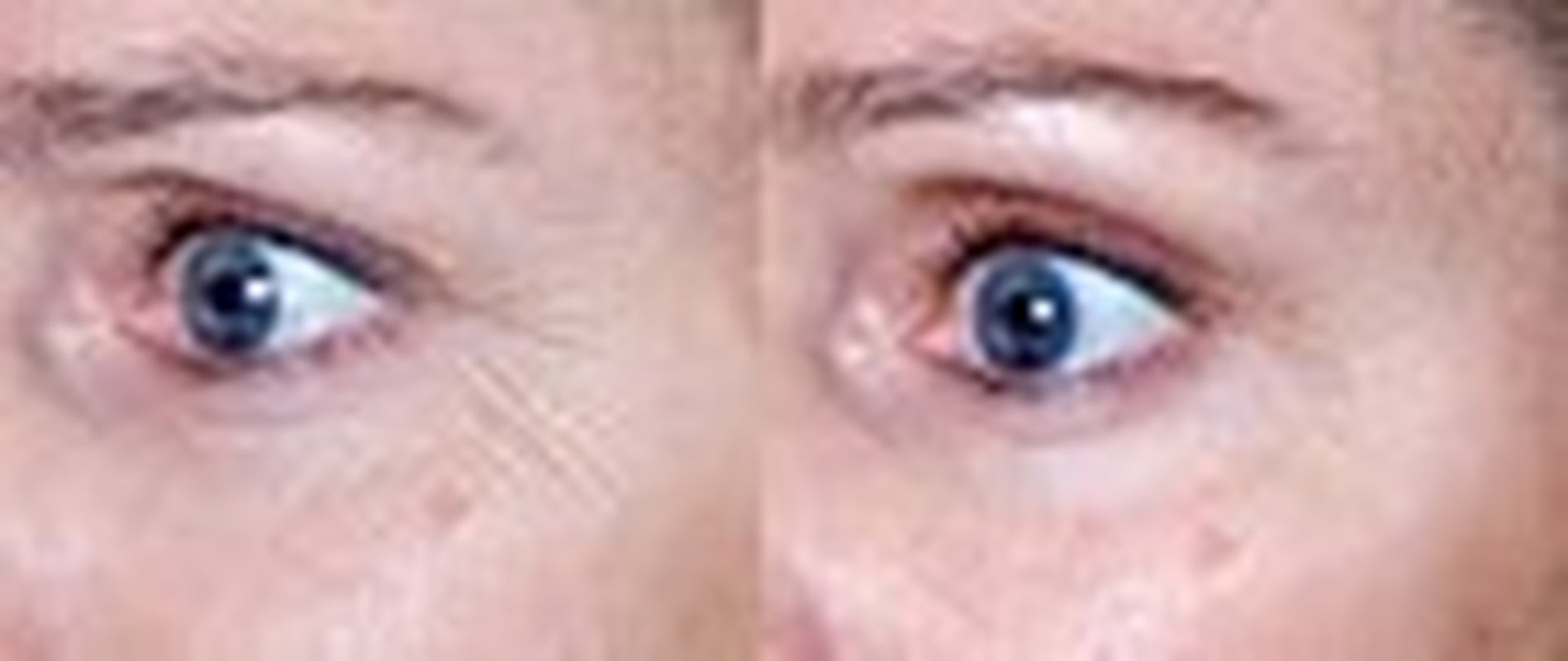 Revitalize Your Skin with Matrixyl 3000 Peptide Cream - Anti-Aging Formula with Hyaluronic Acid, Retinol, and Vitamin C